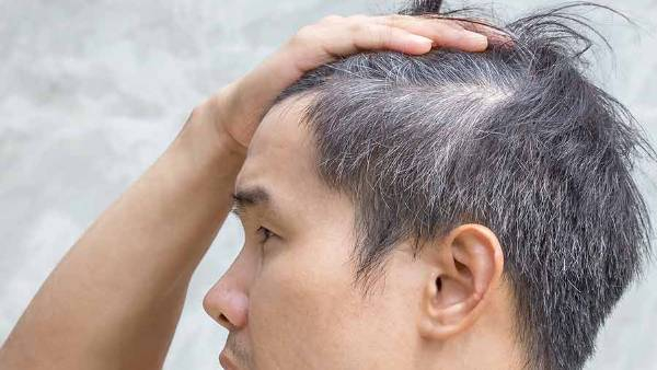 Turn Your Gray Hair Black Naturally An Amazing Home Remedy