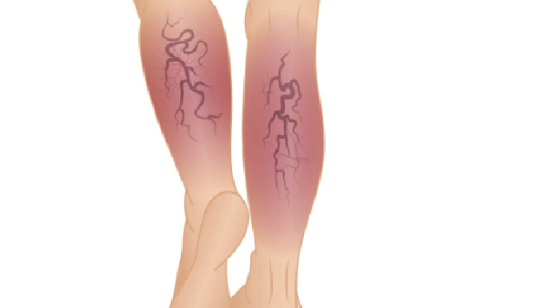 Sitting too long Learn about the risk to your second heart and how to prevent it Sitting too long Learn about the risk to your second heart and how to prevent it