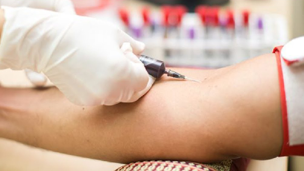 A Doctor s Advice The Essential Annual Blood Tests You Shouldn t Miss