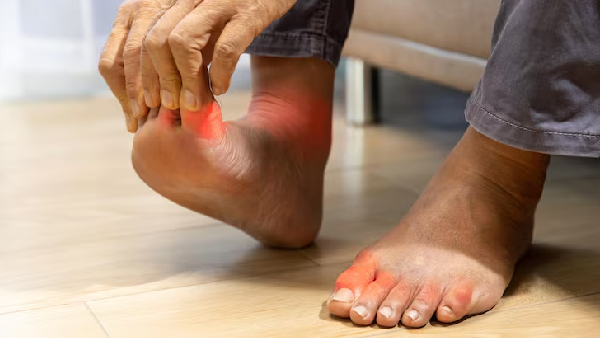 Are Your Feet Warning You Silent Signs of Diabetes You Shouldn t Ignore Are Your Feet Warning You Silent Signs of Diabetes You Shouldn t Ignore