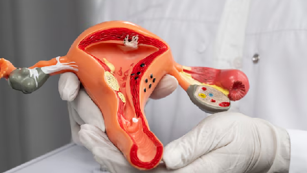 Zero Cervical Cancer Free HPV Vaccine for 14 Year Old Girls Across India