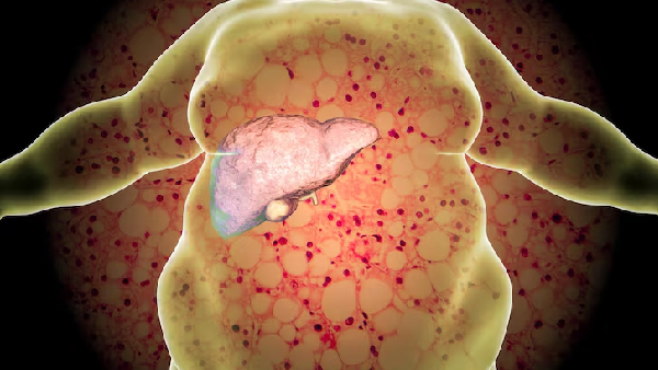 Detox Your Liver Foods to Eat and Foods to Avoid For Healthy Liver