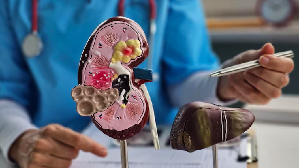 Are Your Daily Food Habits Destroying Your Kidneys Find Out Here