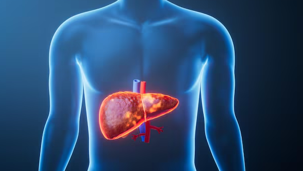 The Bitter Truth Behind Yellow Eyes What Your Eyes Reveal About Your Liver