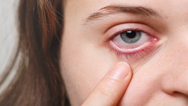 Reasons behind frequent dry eyes Important suggestions to protect
