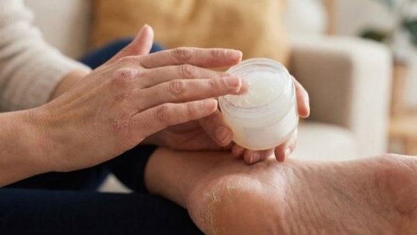 protect your feet with these tips from cracking during the monsoon season protect your feet with these tips from cracking during the monsoon season