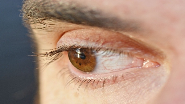 twitching your right eye is a bad omen must know the doctors suggestions