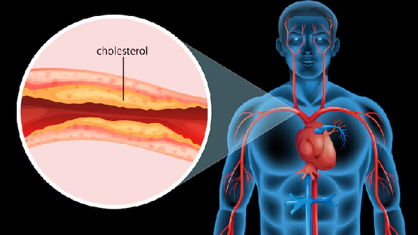 How to Bulletproof Your Heart with Good Cholesterol Discover the Magic of HDL How to Bulletproof Your Heart with Good Cholesterol Discover the Magic of HDL
