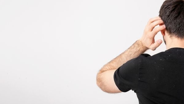 suggestions you should do if you experience sudden hair loss and dandruff suggestions you should do if you experience sudden hair loss and dandruff