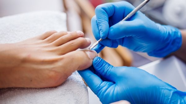 cracked feet during the monsoon season get a pedicure twice a week cracked feet during the monsoon season get a pedicure twice a week