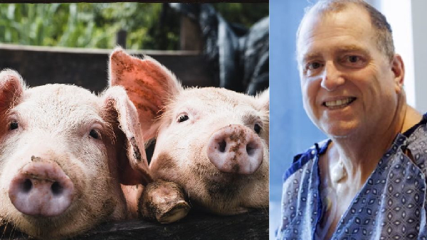 271 Days with a Pig s Kidney The Medical Miracle That Saved a Dying Man