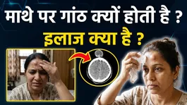 Forehead Lump: Mathe Par Ganth Kyu Hoti Hai,Ilaj Kya Hai ?
