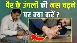 Pair Ki Ungli Ki Nas Chadhne Par Kya Kare,Instant Home Remedy