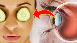 Aankh Me Khujli Ho To Kya Kare: Matlab Aur Gharelu Upay