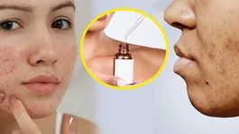 Vitamin C Vs Niacinamide Serum: Dark Spots,Oily Or Dull Skin,Which Is Better for your Skin Type