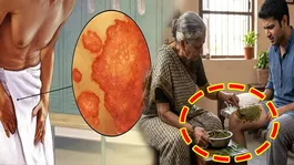 Jangh Me Daad Ka Ilaj: Thigh Ringworm Treatment In Hindi