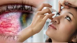 Ankho Ki Naso Me Dard Kyu Hota Hai | Eye Pain Causes &amp; Treatment