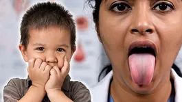 Bacche Ka Totlapan Kaise Theek Karen: Lisping Treatment In Hindi