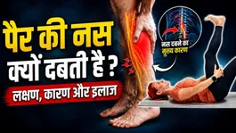 Leg Nerve Compression: Pair Ki Nas Dabne Ke Lakshan,Karan Aur Ilaaj