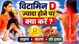 Excess Vitamin D Side Effects: Vitamin D Jyada Hone Par Kya Kare,Lakshan,Karan Aur Ilaj