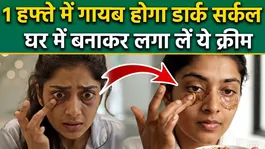 Dark Circle Homemade Cream: Dark Circle Hatane Ke Liye Best Cream Kaise Banaye,Under Eye Home Remedy