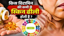 Which Vitamin Deficiency Causes Loose Skin | Vitamin Deficiency Skin Looseness|Aging Skin Treatment