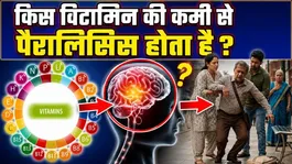 Vitamin Deficiency Diseases: Which vitamin deficiency causes paralysis, Reason for Paralysis |