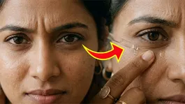 Under Eye Fine Lines Treatment: Aankho Ke Niche Jhuriya Kaise Hataye,Kyu Padte Hai |Best Home Remedy