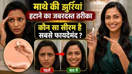 Forehead Wrinkles Removal Serum: Mathe Ki Fine Lines Kaise Dur Kare,Best Serum To Use ?