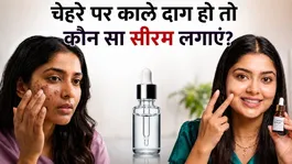 Dark Spot Remover Serum: Which serum to use to remove dark spots from the face |