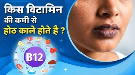 Dark Lips and Vitamin Deficiency:Which Vitamin Deficiency Causes Dark Lips,Treatment for Dark Lips