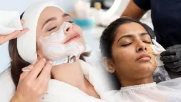 Face Wax After Bleach: Can you bleach after face waxing? Face wax home remedy