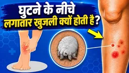 Ghutne Ke Niche Khujli Hona: Ghutne Ke Niche Khujli Hone Ka Karan,Ilaj Aur Gharelu Upay