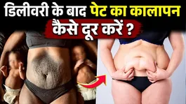 After Pregnancy Dark Belly Remedy: Delivery Ke Bad Pet Ka Kalapan kaise Dur Kare ?