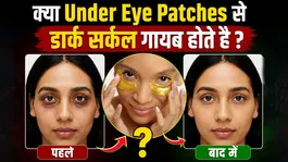 Under Eye Patches For Dark Circles: Review,Benefits &amp; Uses In Hindi