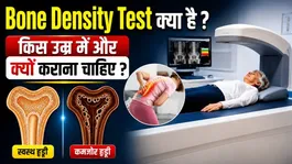 Bone Density Test Explained: Bone Density Test Kya Hota Hai,Kaise Hota Hai,Fayda | Benefits,Age Limit