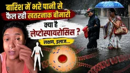 Leptospirosis: What is the leptospirosis spreading through stagnant rain water, Symptoms, treatment