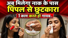 Nose Side Pimple Removal: Nak ke pass pimples kyu hote hai,Side Acne Home Remedy