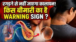 Neck Blackness Removal Tips:Gardan Ka Kalapan Kis Bimari Ka Sanket,Kaise Theek Kare ?