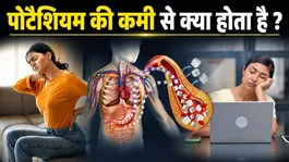 Potassium Deficiency Symptoms: Potassium Ki Kami Se Kya Hota Hai,Lakshan,Karan Aur Ilaj