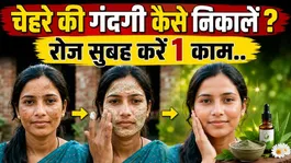 Chehre par Gandgi Kaise Hataye: Nikalne Ka Tarika,Kaise Saaf Karaye ?