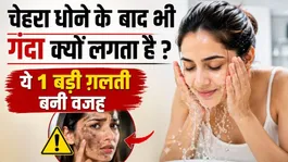 Why Face Looks Dull After Washing? Dermatologist Explains The Real Reason Behind Dark Skin!