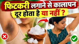 Fitkari Se Kalapan Kaise Dur Kare: Hata Sakte Hai Ki Nahi,Sahi Tarika Kya Hai ?