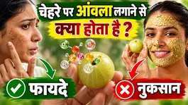 Amla on Skin: Benefits and Side Effects of Applying Amla Powder to the Face