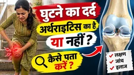 Knee Pain: Is It Arthritis or Not? Symptoms of Knee Pain and How to Identify It