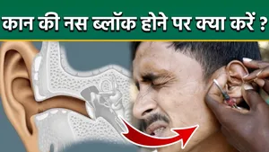 Ear Nerve Block Symptoms: Kaan Ki Nas Block Hona,Karan,Lakshan Aur Ilaj |Treatment In Hindi