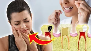 Pulpitis Treatment At Home: Dant Ki Naso Me Dard Ho To Kya Kare,Karan Aur Ilaj ?