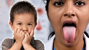 Bacche Ka Totlapan Kaise Theek Karen: Lisping Treatment In Hindi