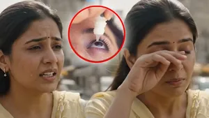 Watery Eyes In Sunlight: Dhup Me Aankh Se Pani Aane Ka Karan Aur Ilaj|Treatment &amp; Home Remedies