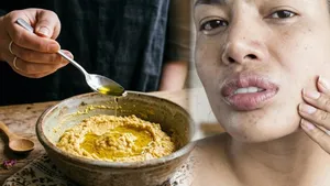 Summer Dry Skin Care: Garmi Me Dry Skin Ke Liye Kya Kare,Chehre Par Kya lagana Chahiye ?